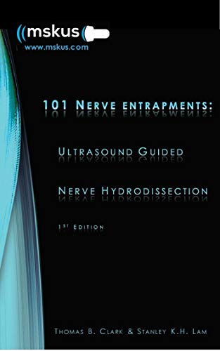 101 Nerve Entrapments: Ultrasound Guided Nerve Hydrodissection: 1st Edition