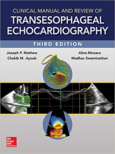 Clinical Manual and Review of Transesophageal Echocardiography, 3/e 3rd Edition