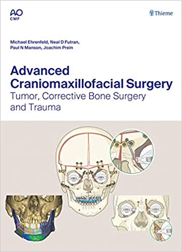 Advanced Craniomaxillofacial Surgery : Tumor, Corrective Bone Surgery, and Trauma1st Edition First ed 1e