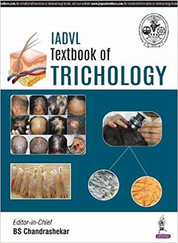 IADVL Textbook of Trichology (1e, first ed) 1st Edition