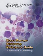 Bone Marrow Benchtop Reference Guide by FCAP Yuri Fedoriw, MD, FCAP; Parul Bhargava, MD (Author), FCAP Kyle T. Bradley, MD, FCAP; John L. Frater, MD (Author), BSc Michael R. Lewis, MD, FCAP; Ria Vergara-Lluri, MD, FCAP; Amy Thommasen, MD (Author)