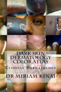 Dark Skin Dermatology Color Atlas: Clinical Dermatology  by Dr Miriam Kinai (Author)
