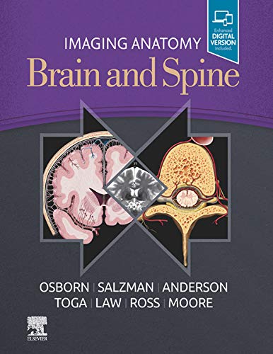 Imaging Anatomy Brain and Spine 1st Edition by Anne G. Osborn MD FACR (Author), Karen L. Salzman MD (Author), Jeffrey S Anderson MD PhD (Author), Arthur W. Toga (Author), Meng Law MD (Author), Jeffrey Ross MD (Author), Kevin R. Moore MD (Author)